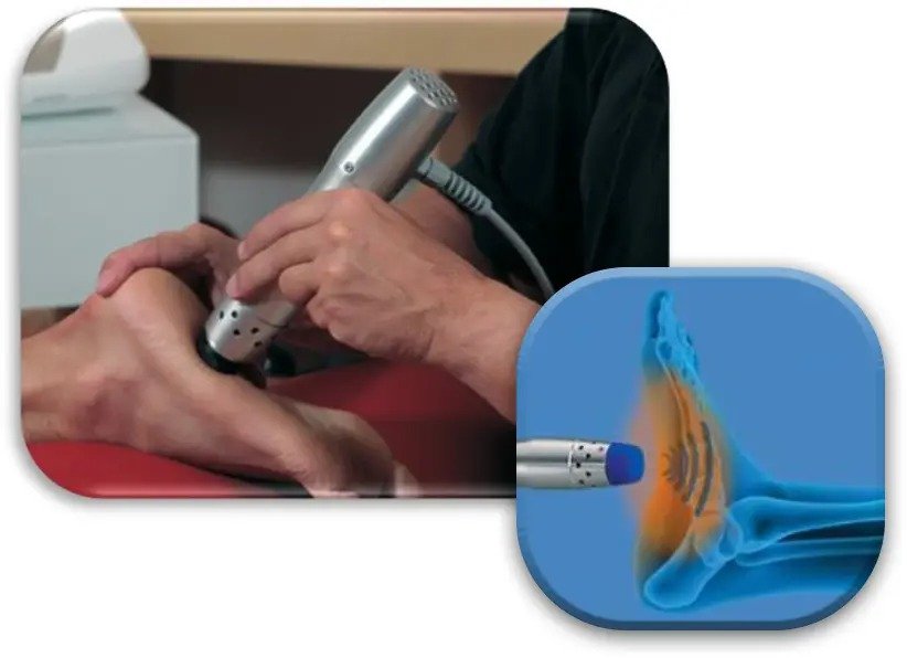 Shockwave Therapy - Biotech Radiva